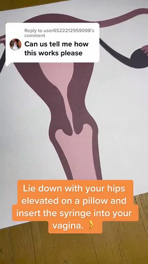 Here’s how to do home insemination🌈❤️