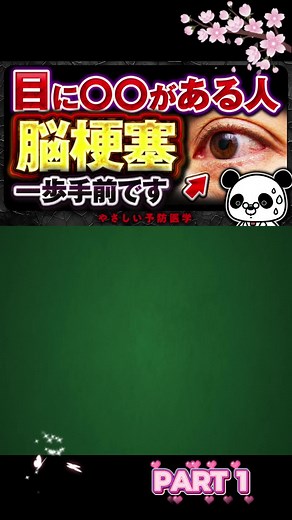 脳梗塞の前兆｜目に現れる危険な異変と見分け方