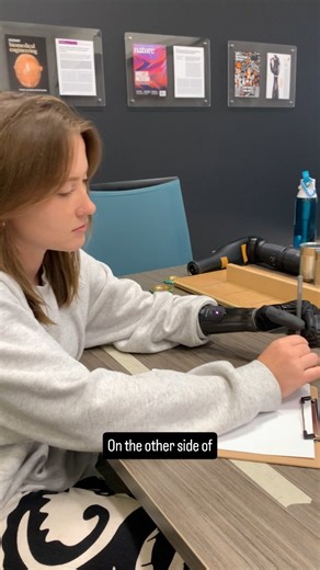 PSYONIC on Instagram: "How well can a bionic hand write? ✍️ In this test, you can see how Anni uses her Ability Hand to write a 24-letter sentence after seeing it just once. It’s part of a clinical assessment called the Jebsen Taylor Hand Function Test that uses everyday activities (like writing, feeding, and lifting) to measure real-world hand function. Small tasks, big impact. 🦾 #AbilityHand #Bionics #Prosthetics #LimbDifference #Accessibility"*"