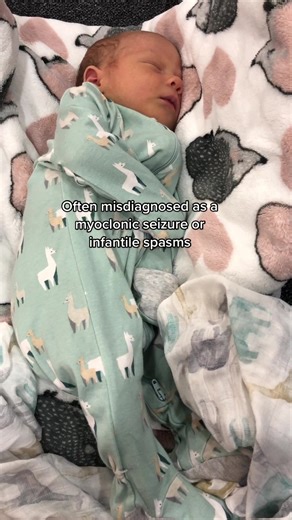 Understanding Infantile Spasms: Symptoms, Causes, and Treatment