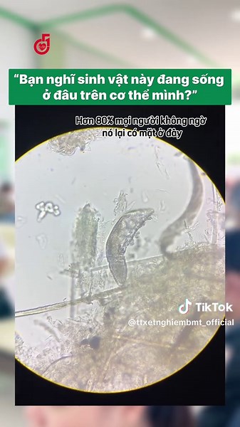 Dấu Hiệu Demodex và Cách Nhận Biết