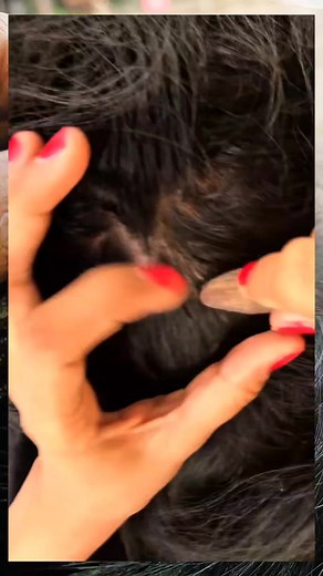 Lice #asmr | Removing Lice