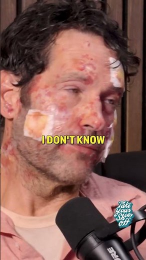 Paul Rudd's Burn Injuries 👆FULL VIDEO