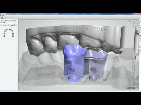 Dental System™ 2012 - Model Builder™