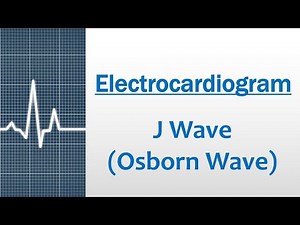 J wave (Osborn wave) [Electrocardiogram]