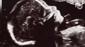 La quête de « l’utérus artificiel » : entre fiction et avancées de la recherche