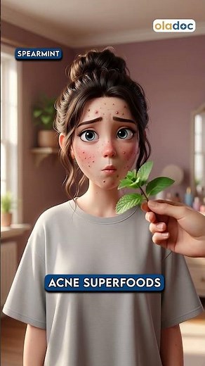 6 Superfoods To Clear Acne Naturally - Acne Treatment at Home #viral #ytshorts #ai #trending #acne