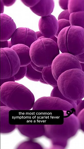 Scarlet Fever