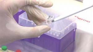 風濕藥IL-6 竟成武漢肺炎救命神藥？