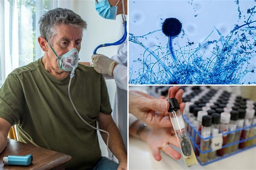 Dangerous fungus could spread to parts of US, researchers claim