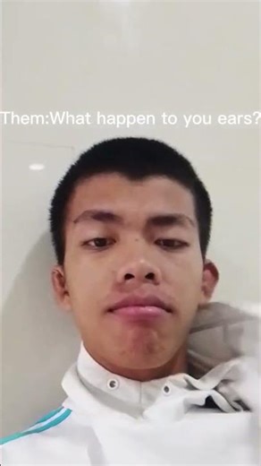 Cauliflower Ear 👂#boxinglife #bjj #jiujitsu #sports #mma #boxing #motivation #fightpr #pointsparring