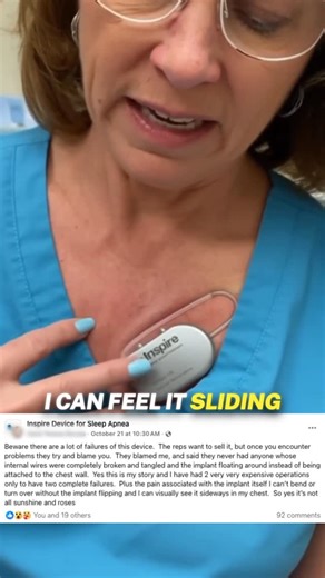 Cpap Reviews on Instagram: "“Beware! There a lot of failures with this device. The reps want to sell it but once you encounter a problem they try and blame you 😳” - Inspire Implant Patient #sleepapnea #cpap #sleep #inspireimplant #otolaryngology #otolaryngologist #respiratory #surgery #medical"