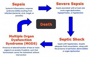 Stages of Sepsis