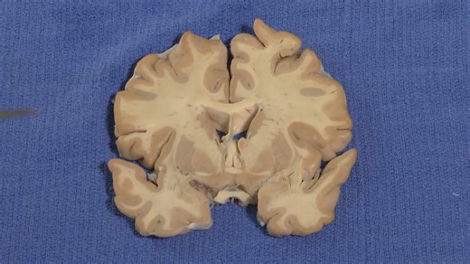 24Hypothalamus （下丘脑）