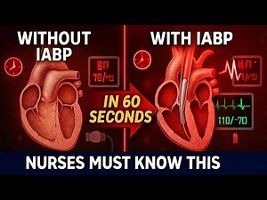 This Balloon Inside Your Heart Can Kill or Cure in Seconds (IABP Explained)