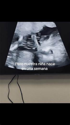 Siempre dije que no me gustaba prometer nada sin tener la certeza de poder cumplirlo y que no me gustaba que me prometieran cosas que no sabrían si cumplirían. Así que jur0 cumplir todo lo que prometió y bueno… #mamasdetiktok #mamassolteras #bebeniña #paratipage #expareja