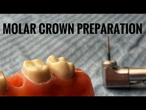 Molar Crown Preparation