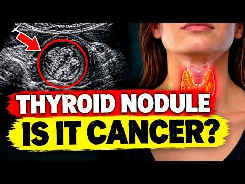 10 Signs of THYROID CANCER You Should NEVER Ignore! Is a Thyroid Nodule Cancerous?