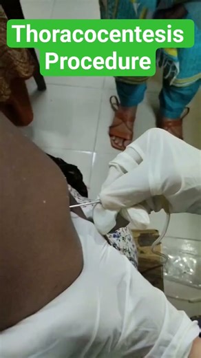 Thoracocentesis Procedure.