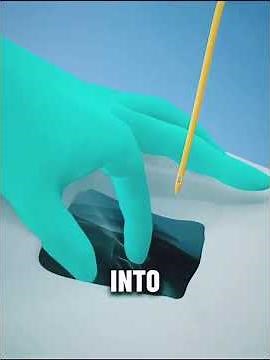 How to Insert Female Foley Catheter Gently | Step-by-Step Animation 🏥