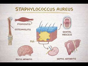 Staph Aureus in 5 Minutes | Infections, Toxins & Treatment
