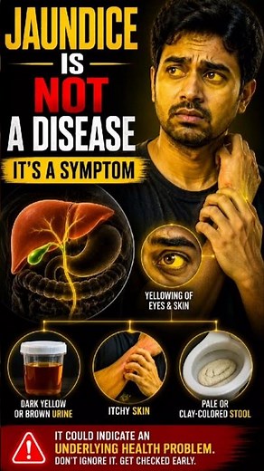 Jaundice (Yellow Skin & Eyes) Explained | Causes, Symptoms & Warning Signs You Should Know 🟡🩺