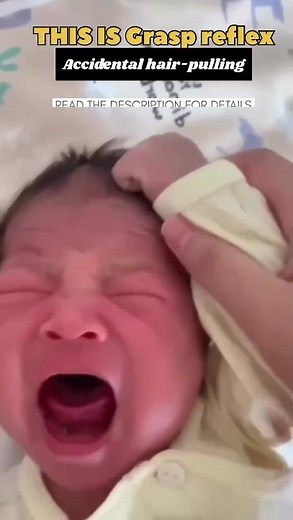 Why Do Babies Pull Their Own Hair and Cry? #baby #cute