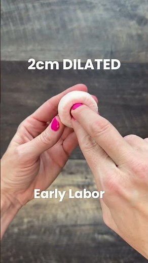 Dilation Progression: Your Body in Labor