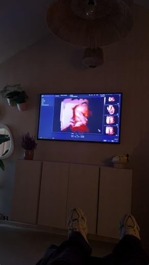 Meet our babygirlllll! 👶🏻 @Baby in Beeld | Pretecho T/m 11 januari is de code NAOMIARIEL in te vullen in het opmerkingenveld 20% korting op alle echo’s. 🩷 ps ook heel leuk om cadeau te doen.