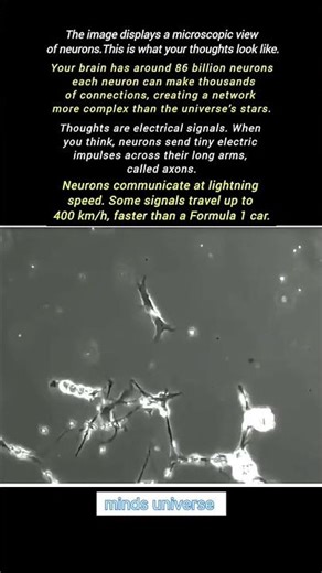 microscopic view of neurons #science #scienceshorts #microbiology