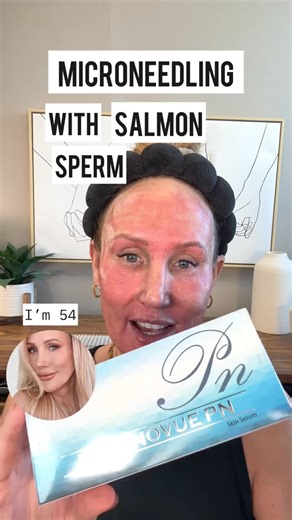 Stacy Snook on Instagram: "Microneedling with Salmon Sperm based skin boosters is a great way to treat the signs of aging, improve skin texture, hydration, and glow, AND build collagen and elastins in the skin! I order all my high quality skin boosters from Acecosm.com discount code STACY10 ❤️ #microneedling #diymicroneedling #antiagingtreatment #skincareover40 #beautifulskin"