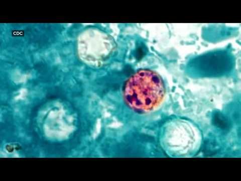 CDC issues warning about parasitic stomach bug causing explosive diarrhea