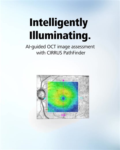 2.3K views · 24 reactions | Introducing ZEISS CIRRUS PathFinder – a...