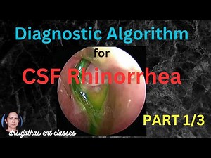 234.CSF Rhinorrhea Part 1/3 / Diagnostic Algorithm for Cerebrospinal Fluid Leak #surgeryeducation