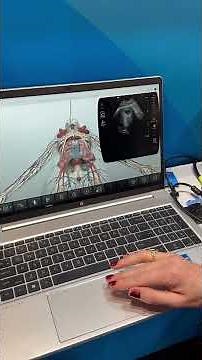 Practice scanning OB ultrasound with the SonoSimulator®! #education #ultrasound #obgyn