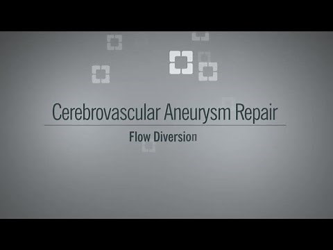 Aneurysm Flow Diversion