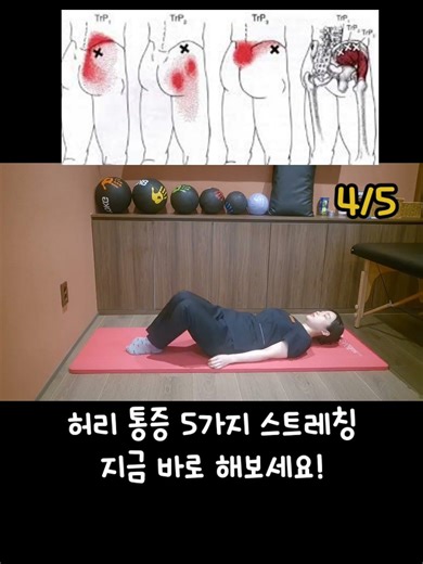 허리 디스크 빠르게 해결하는 법