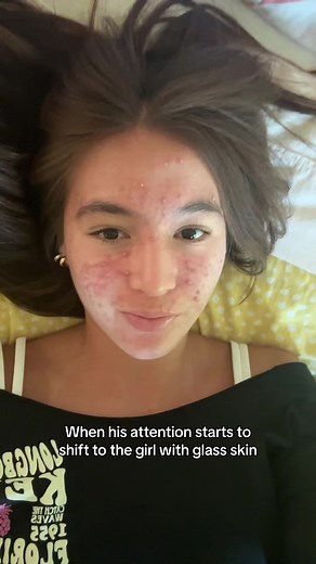 skin journey on TikTok
