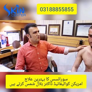 سورائسس (Psoriasis) کے مریض اب پریشان نہ ہوں۔ ڈاکٹر سید بلال شمس روایتی طریقہ علاج سے ہٹ کر اس کا علاج امریکن اور یورپین مشینوں سے؛ ■ Excimer Laser 308nm by DEKA Italy ■ Waldmann NB UVB Phototherapy Germany ■ PUVA machine by Waldmann Germany کررہے ہیں۔ #psoriasis #Excimer #laser #dermatologist #drsyedbilalshams #best dermatologist | Skin center