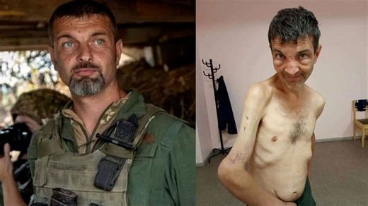 [뉴스딱] 앙상한 몸에 뒤틀린 팔…생환 '러 포로' 처참한 몸 상태