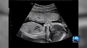 40K views · 868 reactions | Congrats to WAVY10 anchor Madison Pearman on her pregnancy announcement today! | WAVY TV 10 | Facebook