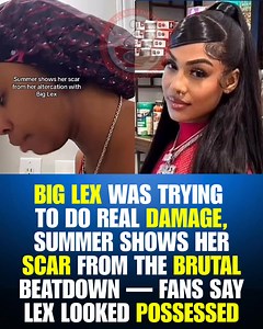 Summer finally showed the scar left behind from her explosive fight with Big Lex and the internet is shook. Fans swear Lex was fighting with bad intentions, claiming her whole demeanor looked “possessed” during the altercation. #SummerNoneOther #BigLex #baddiesusa | All About The Tea