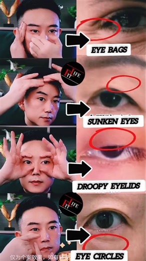 Four Facial Yoga Exercises To Improve The Eye Area 😱 #yoga #eyes #skincare #eyebags #fit #shorts