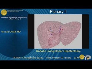 Robotic Living Donor Hepatectomy • Video • MEDtube.net