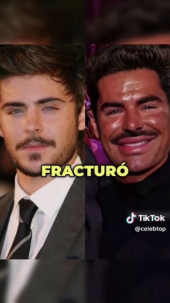 4 estrellas que sobrevivieron a accidentes dignos de Destino Final. | Zac Efron