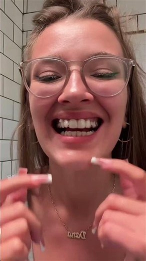 #tray 7/24 on my #invisalign journey 💅✨ ​ #orthodontics