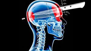 When You Don't Have Health Insurance—Gaming Realism