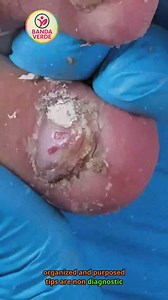 Ep.567 Casual meetup portion control and calorie habits 🍉🌹 #CalorieControl #HeartHealthyDiet #WellnessLifestyle | Banda Verde