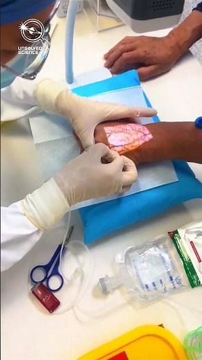 Mind Blowing Vein Detection Technology