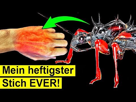 What happens if you get bitten by the world's largest assassin bug?